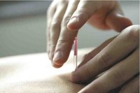 なぜ鍼灸は効果があるのか？