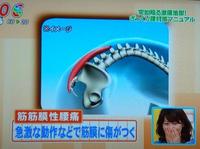 鍼灸は「ぎっくり腰」も即効対応！