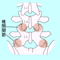 生活の中にある「ぎっくり腰」の危険性