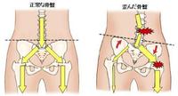 岡山県岡山市在住、股関節からくる腰痛の改善例